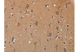 The image on the left is immunohistochemistry of paraffin-embedded Human brain tissue using ABIN7191717(NRG3 Antibody) at dilution 1/30, on the right is treated with synthetic peptide. (Neuregulin 3 抗体)