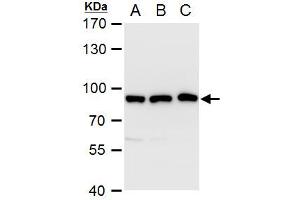 WB Image VPS35 antibody [C3], C-term detects VPS35 protein by western blot analysis. (VPS35 抗体  (C-Term))