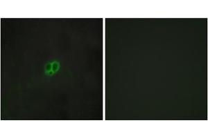 Immunofluorescence analysis of MCF-7 cells, using CRHR1 antibody. (CRHR1 抗体  (Internal Region))