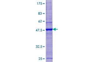 ESCO1 Protein (AA 1-172) (GST tag)