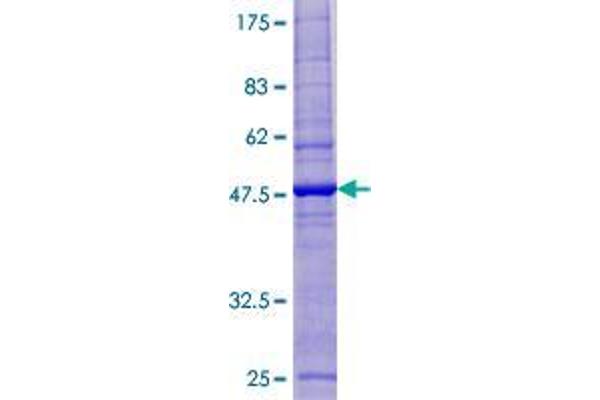 ESCO1 Protein (AA 1-172) (GST tag)