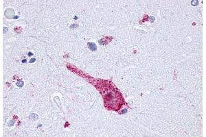 Anti-OPRM1 / Mu Opioid Receptor antibody  ABIN1049171 IHC staining of human brain, neuron. (Mu Opioid Receptor 1 抗体  (C-Term))