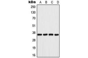 Western blot analysis of Aldose Reductase expression in Jurkat (A), HeLa (B), SP2/0 (C), PC12 (D) whole cell lysates. (AKR1B1 抗体  (C-Term))