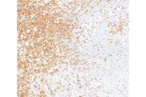 Immunohistochemistry (IHC) image for anti-CD247 Molecule (CD247) (C-Term) antibody (ABIN7455240) (Recombinant CD247 抗体  (C-Term))
