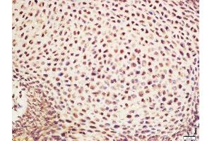 Immunohistochemistry (Paraffin-embedded Sections) (IHC (p)) image for anti-NADH Dehydrogenase (Ubiquinone) 1 alpha Subcomplex, 1, 7.5kDa (NDUFA1) (AA 31-70) antibody (ABIN751693)