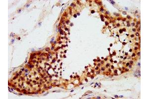 IHC image of ABIN7151284 diluted at 1:600 and staining in paraffin-embedded human testis tissue performed on a Leica BondTM system.