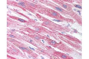 Anti-CRIP2 antibody IHC of human heart. (CRIP2 抗体  (AA 78-127))