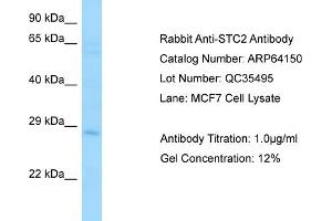 Western Blotting (WB) image for anti-Stanniocalcin 2 (STC2) (C-Term) antibody (ABIN2789749) (Stanniocalcin 2 抗体  (C-Term))