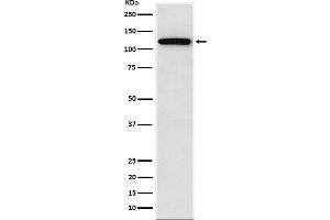 Western blot analysis of Sortilin expression in SW480 cell lysate. (Recombinant Sortilin 1 抗体)