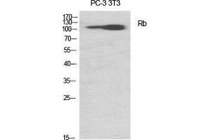 Western Blot (WB) analysis of specific cells using Rb Polyclonal Antibody. (Retinoblastoma 1 抗体  (Thr676))