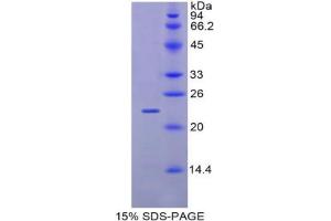 SDS-PAGE analysis of Mouse GaA Protein. (GAA 蛋白)