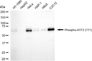 Western blotting analysis using phospho-ATF2 (T71) antibody (ABIN7797480).