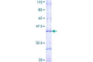 CPT1B Protein (AA 673-772) (GST tag)