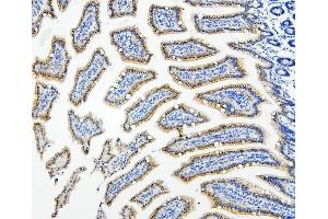 IHC analysis of HDAC5 using anti-HDAC5 antibody (ABIN7599922). (HDAC5 抗体  (AA 13-1107))
