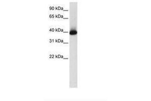 Image no. 1 for anti-GS Homeobox 2 (GSX2) (AA 214-263) antibody (ABIN203048)