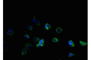 Immunofluorescent analysis of MCF-7 cells using ABIN7173107 at dilution of 1:100 and Alexa Fluor 488-congugated AffiniPure Goat Anti-Rabbit IgG(H+L) (TMEM184B 抗体  (AA 311-407))
