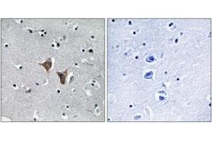 Immunohistochemistry analysis of paraffin-embedded human brain, using WASF4 Antibody. (WASF4 抗体  (AA 190-239))