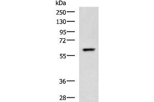 Western blot analysis of A549 cell lysate using TERF1 Polyclonal Antibody at dilution of 1:400 (TRF1 抗体)