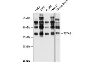 Western blot analysis of extracts of various cell lines, using TST antibody (ABIN6127523, ABIN6149663, ABIN6149664 and ABIN6220526) at 1:1000 dilution. (TSTA3 抗体  (AA 1-321))