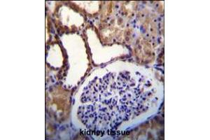 WNK3(PRKWNK3) Antibody immunohistochemistry analysis in formalin fixed and paraffin embedded human kidney tissue followed by peroxidase conjugation of the secondary antibody and DAB staining. (WNK3 抗体  (C-Term))