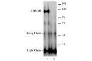 JMJD2B / KDM4B antibody (rAb) tested antibody tested by immunoprecipitation. (Recombinant KDM4B 抗体)