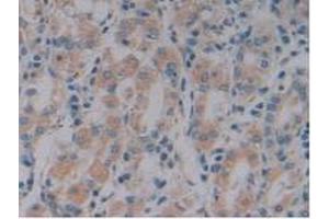 Detection of NOSTRIN in Human Stomach Tissue using Polyclonal Antibody to Nitric Oxide Synthase Trafficker (NOSTRIN) (NOSTRIN 抗体  (AA 18-251))