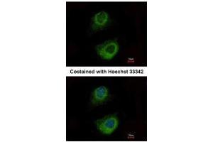 ICC/IF Image Immunofluorescence analysis of methanol-fixed HeLa, using HSP70 1B, antibody at 1:500 dilution. (HSPA1B 抗体  (Center))