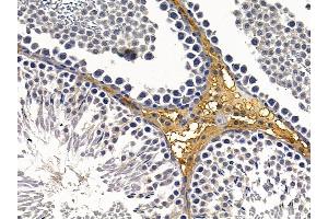 ABIN6260161 and ABIN6279063 at 1/100 staining rat testis tissue by IHC-P. (AWAT2 抗体  (Internal Region))