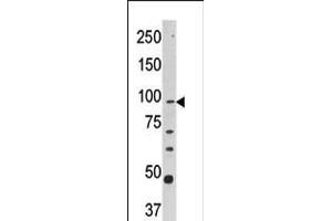 Western blot analysis of anti-CPT1A Pab in Y79 cell line lysate (35ug/lane).