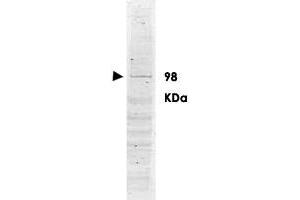 Western blot using POLK polyclonal antibody  shows detection ofa band ~98 KDa corresponding to human POLK (arrowhead). (POLK 抗体  (AA 817-830))