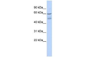 ZNF415 antibody used at 5 ug/ml to detect target protein. (ZNF415 抗体  (N-Term))