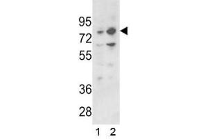 Western blot analysis of PLZF antibody and 1) 293 and 2) K562 lysate (ZBTB16 抗体  (AA 637-666))
