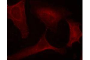 Immunofluorescence staining of methanol-fixed Hela cells using MEK1(Phospho-Ser221) Antibody. (MEK1 抗体  (pSer221))