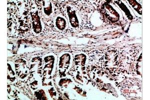 Immunohistochemical analysis of paraffin-embedded human-colon, antibody was diluted at 1:200 (VHL 抗体  (AA 1-50))