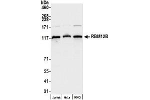 anti-RNA Binding Motif Protein 12B (RBM12B) (AA 525-575) antibody