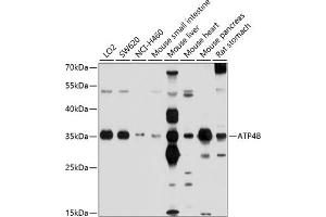 Western blot analysis of extracts of various cell lines, using B antibody (ABIN6130981, ABIN6137322, ABIN6137323 and ABIN6214233) at 1:1000 dilution. (ATP4b 抗体  (AA 62-291))