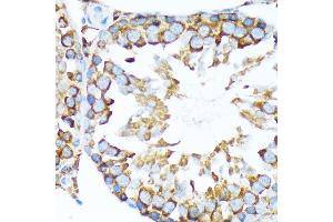 Immunohistochemistry of paraffin-embedded rat testis using STIP1 Rabbit mAb (ABIN1512566, ABIN3020619, ABIN3020620 and ABIN7101303) at dilution of 1:100 (40x lens). (STIP1 抗体)
