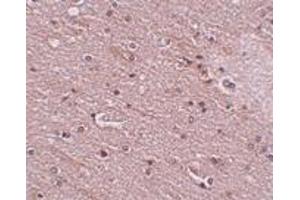 Immunohistochemistry (IHC) image for anti-Anoctamin 2 (ANO2) (N-Term) antibody (ABIN1031629) (Anoctamin 2 抗体  (N-Term))