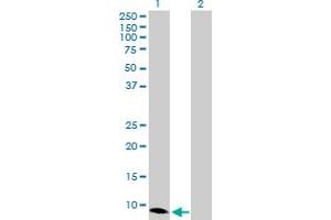 Western Blot analysis of CXCL10 expression in transfected 293T cell line by CXCL10 MaxPab polyclonal antibody. (CXCL10 抗体  (AA 1-98))
