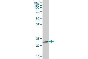 AK1 MaxPab polyclonal antibody. (Adenylate Kinase 1 抗体  (AA 1-194))