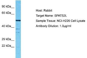 Host: Rabbit Target Name: SPATS2L Sample Tissue: Human NCI-H226 Whole Cell Antibody Dilution: 1ug/ml (SPATS2L 抗体  (N-Term))
