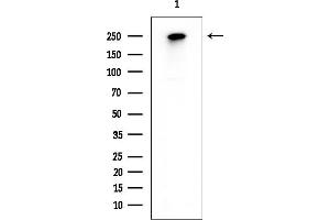 Western blot analysis of lysates from EC304 cells, using POLR2A Mouse Monoclonal Antibody at 1/1000 dilution.