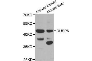Western blot analysis of extracts of various tissues, using DUSP6 antibody.