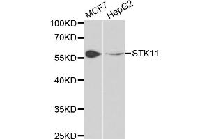 Western blot analysis of extracts of various cell lines, using STK11 antibody (ABIN5971149) at 1/1000 dilution. (LKB1 抗体)