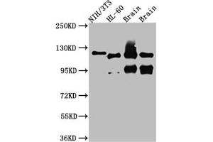 Western Blot Positive WB detected in: NIH/3T3 whole cell lysate, HL-60 whole cell lysate, Rat Brain whole cell lysate, Mouse Brain whole cell lysate All lanes: OGT antibody at 1:1000 Secondary Goat polyclonal to rabbit IgG at 1/50000 dilution Predicted band size: 117, 104, 116, 75 kDa Observed band size: 117 kDa (Recombinant OGT 抗体)