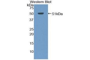 Western Blotting (WB) image for anti-Tumor Necrosis Factor Receptor Superfamily, Member 13C (TNFRSF13C) (AA 3-175) antibody (ABIN3208905) (TNFRSF13C 抗体  (AA 3-175))