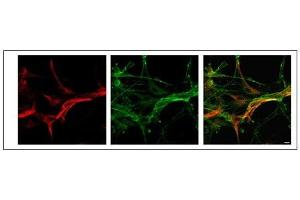 MLC1 antibody used at a dilution of 1:50 to detect rat astrocytes. (MLC1 抗体  (Middle Region))