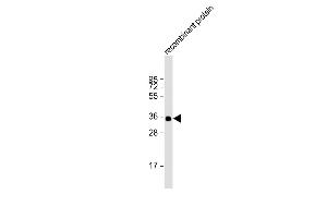 Anti-BRCA2 Antibody at 1:2000 dilution + recombinant protein Lysates/proteins at 20 μg per lane. (BRCA2 抗体  (AA 251-495))