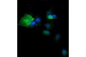 Image no. 4 for anti-Deleted in Primary Ciliary Dyskinesia Homolog (DPCD) antibody (ABIN1497889) (DPCD 抗体)