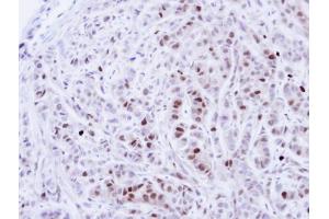 IHC-P Image Immunohistochemical analysis of paraffin-embedded A549 Xenograft, using NEK4, antibody at 1:100 dilution. (NEK4 抗体)